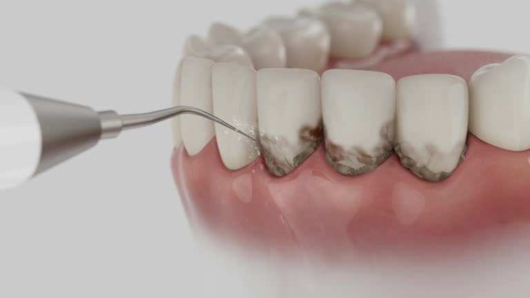 Trusted Wisdom Tooth Removal service in Bernie, MO - Dentist Open Now